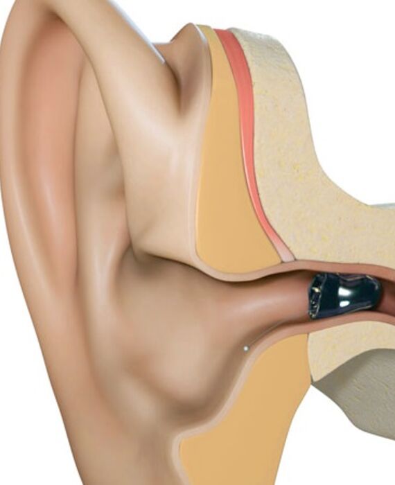 IIC_anatomy
